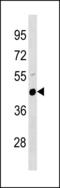 Plasminogen Activator, Urokinase antibody, LS-C203790, Lifespan Biosciences, Western Blot image 