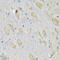 Thioredoxin Domain Containing 5 antibody, 15-399, ProSci, Immunohistochemistry frozen image 