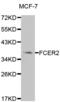 Fc Fragment Of IgE Receptor II antibody, abx001520, Abbexa, Western Blot image 