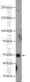 Transmembrane Protein 119 antibody, 27585-1-AP, Proteintech Group, Western Blot image 