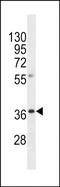 Olfactory Receptor Family 8 Subfamily A Member 1 antibody, PA5-49225, Invitrogen Antibodies, Western Blot image 