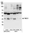 Transmembrane P24 Trafficking Protein 1 antibody, A304-485A, Bethyl Labs, Western Blot image 