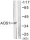 SUMO1 Activating Enzyme Subunit 1 antibody, abx013214, Abbexa, Western Blot image 