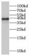 Thymus, Brain And Testes Associated antibody, FNab00997, FineTest, Western Blot image 