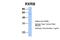 Retinoid X Receptor Beta antibody, 30-088, ProSci, Western Blot image 