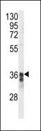 Transmembrane Protein 173 antibody, LS-C161933, Lifespan Biosciences, Western Blot image 