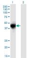 Oncostatin M Receptor antibody, H00009180-M03, Novus Biologicals, Western Blot image 