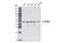Small RNA Binding Exonuclease Protection Factor La antibody, 2081S, Cell Signaling Technology, Western Blot image 
