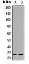 Gap Junction Protein Beta 7 antibody, LS-C358993, Lifespan Biosciences, Western Blot image 