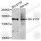 Adenylate Cyclase 2 antibody, A9805, ABclonal Technology, Western Blot image 