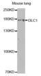 DLC1 Rho GTPase Activating Protein antibody, abx001569, Abbexa, Western Blot image 
