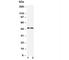 Caspase 2 antibody, R30278, NSJ Bioreagents, Western Blot image 