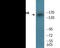 Insulin Like Growth Factor 1 Receptor antibody, EKC1966, Boster Biological Technology, Western Blot image 