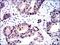 Baculoviral IAP Repeat Containing 5 antibody, GTX60534, GeneTex, Immunohistochemistry paraffin image 