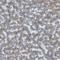 Branched Chain Keto Acid Dehydrogenase Kinase antibody, NBP1-86052, Novus Biologicals, Immunohistochemistry paraffin image 