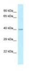 ST6 N-Acetylgalactosaminide Alpha-2,6-Sialyltransferase 2 antibody, NBP1-98415, Novus Biologicals, Western Blot image 