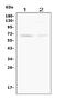SMAD Family Member 4 antibody, MA1089, Boster Biological Technology, Western Blot image 