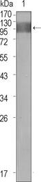 Fms Related Tyrosine Kinase 1 antibody, GTX83314, GeneTex, Western Blot image 