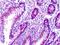 PEAK1 Related, Kinase-Activating Pseudokinase 1 antibody, orb95220, Biorbyt, Immunohistochemistry paraffin image 