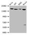 LIF Receptor Subunit Alpha antibody, LS-C670584, Lifespan Biosciences, Western Blot image 