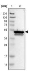 Cytochrome b5 reductase 4 antibody, NBP1-88957, Novus Biologicals, Western Blot image 