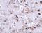 Transmembrane Protein 18 antibody, GTX31972, GeneTex, Immunohistochemistry paraffin image 