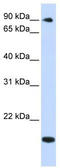 TSR1 Ribosome Maturation Factor antibody, TA339343, Origene, Western Blot image 