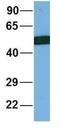 Solute Carrier Family 39 Member 6 antibody, NBP1-59357, Novus Biologicals, Western Blot image 