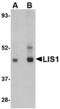 Platelet Activating Factor Acetylhydrolase 1b Regulatory Subunit 1 antibody, MBS150442, MyBioSource, Western Blot image 