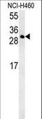 Coiled-Coil Domain Containing 69 antibody, LS-C168432, Lifespan Biosciences, Western Blot image 