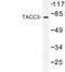 Transforming Acidic Coiled-Coil Containing Protein 3 antibody, LS-C177074, Lifespan Biosciences, Western Blot image 