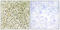 DLC1 Rho GTPase Activating Protein antibody, abx013765, Abbexa, Immunohistochemistry paraffin image 