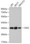 Cyclin Dependent Kinase 2 antibody, 19-709, ProSci, Western Blot image 