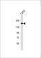 Phosphatidylinositol-3,4,5-Trisphosphate Dependent Rac Exchange Factor 1 antibody, 63-957, ProSci, Western Blot image 