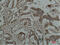 Heat Shock Protein Family B (Small) Member 1 antibody, GTX34000, GeneTex, Immunohistochemistry paraffin image 