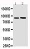 Fibroblast Growth Factor Receptor 3 antibody, PA2143, Boster Biological Technology, Western Blot image 