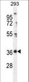 IZUMO1 Receptor, JUNO antibody, LS-C166207, Lifespan Biosciences, Western Blot image 