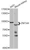 Zinc Finger Protein 544 antibody, STJ29504, St John