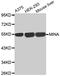 Ribosomal Oxygenase 2 antibody, MBS126918, MyBioSource, Western Blot image 