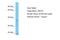 CCR4-NOT transcription complex subunit 8 antibody, A05401, Boster Biological Technology, Western Blot image 