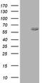 Heat Shock Protein Family D (Hsp60) Member 1 antibody, TA800757BM, Origene, Western Blot image 
