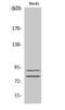 Transglutaminase 2 antibody, STJ95990, St John