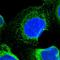 SEC62 Homolog, Preprotein Translocation Factor antibody, HPA014059, Atlas Antibodies, Immunofluorescence image 
