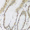 Methyltransferase Like 7A antibody, A14279-2, Boster Biological Technology, Immunohistochemistry paraffin image 