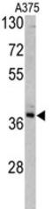 Transaldolase 1 antibody, AP17775PU-N, Origene, Western Blot image 