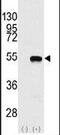 SET And MYND Domain Containing 2 antibody, PA5-11178, Invitrogen Antibodies, Western Blot image 