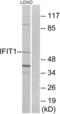 Interferon Induced Protein With Tetratricopeptide Repeats 1 antibody, LS-C119527, Lifespan Biosciences, Western Blot image 