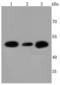 ATP Synthase F1 Subunit Beta antibody, A32270-1, Boster Biological Technology, Western Blot image 