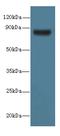 Testis Specific 10 antibody, A61542-100, Epigentek, Western Blot image 