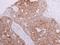 FAST Kinase Domains 3 antibody, NBP1-33138, Novus Biologicals, Immunohistochemistry paraffin image 